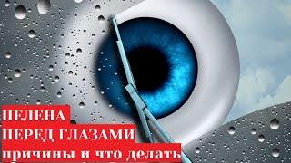 Туман (пелена) перед глазами  причины и лечение