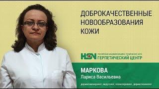 Доброкачественные новообразования кожи