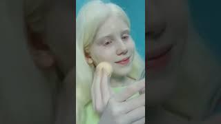 Bullying because of albinism #shorts #albino #bullying #albino #problems