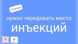 Места для инъекций инсулина