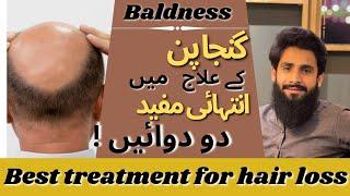 How to Treat Baldness | Best Treatment for Hairloss | Minoxidil | Dr. AbuBakar Bhutta