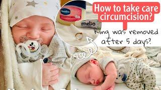 How to take care circumcision on newborn baby? / Sheryl Squad