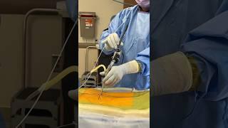 Healing the Spine, One Annular Tear at a Time