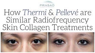 How Pelleve and Thermi Work the Same in Generating Collagen, and Other Ways to Improve the Skin