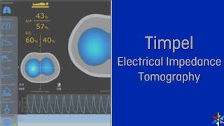 Timpel - Electrical Impedance Tomography