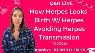 How Herpes Looks Like, Giving Birth With Herpes, Avoiding Herpes Transmission - Live 11/29/2022