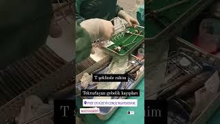 T ŞEKLİNDE RAHİM-ÇOCUK İSTEMİ