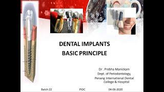 DENTAL IMPLANTS  BASIC PRINCIPLE