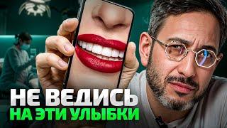 ВИНИРЫ в 2025: Как НЕ разрушить зубы ради «красоты»?