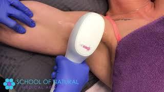 Laser Hair Removal - Medical Aesthetics School