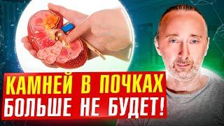 Главная причина камней в Почках: как их растворить за 4 шага?