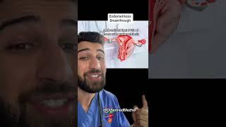 Did Scientists Just Discover the Cause of Endometriosis?! #breakthrough
