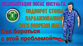 Подворот стопы при шаге парализованной ногой после инсульта - как исправить.