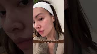 Hey Houston  Your secret to glowing skin is here  Try our world famous Signature Laser facial today
