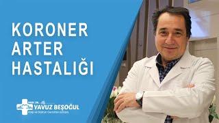 Koroner Arter Hastalığı | Kalp ve Damar Cerrahisi - Prof. Dr. Yavuz Beşoğul