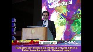 Management of autosomal dominant polycystic kidney in kidney transplantation. Dr. Mohamed Magdy