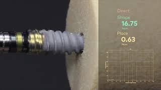 Nobel Biocare N1™ | Predictable implant insertion torque