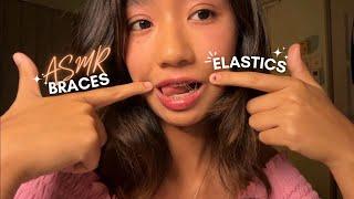 ASMR ~ MY LAST BRACES TAPPING WITH ELASTICS VIDEO