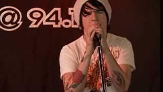 Framing Hanley "Lollipop" (Acoustic)