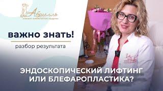 Эндоскопическая подтяжка или верхняя блефаропластика? Что подойдет вам? #кочнева #абриелль #спб