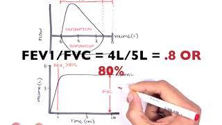 Understanding Spirometry - Normal, Obstructive vs Restrictive