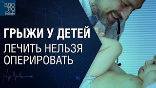 Грыжи у детей. Лечить нельзя оперировать. На здоровье 12.06.2021