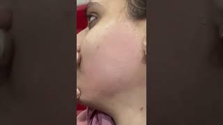 Brazilian officials wax #Brazilian face waxing #youtubeshorts #facialhair #facialwaxing