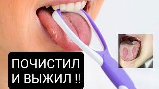 Чистка языка | как чистить язык