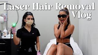 My Full-Body Laser Hair Removal Journey | Watch Before You Start (Vlog + Q/A)