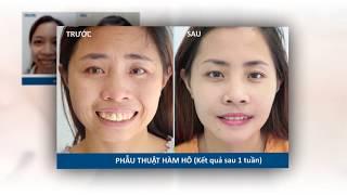 Bệnh viện thẩm mỹ JW hành trình thương hiệu uy tín số 1 hiện nay