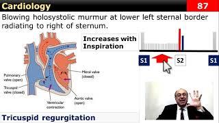 Cardiology (Note)  #internal_medicine #cme #محاضرات_باطنة #usmle #usmleprep #medlearn