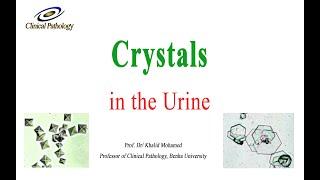 Urine analysis Part 4:  Crystals in urine sediment