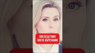  Стоит ли делать обрезание?
