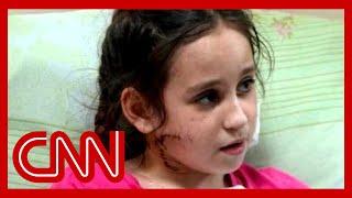 Ukrainian family: 11-year-old girl shot in face by Russian soldier