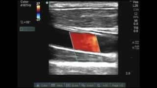 Primer for Basic Ultrasound Physics