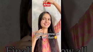 How to reduced Hairfall & regrow lost Hair | my Hairloss to HairGrowth journey #shorts #hairfall