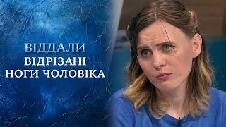 НОГИ В ПАКЕТІ?! Лікарі віддали ЖІНЦІ відрізані ноги ЧОЛОВІКА! "Говорить Україна". Архів