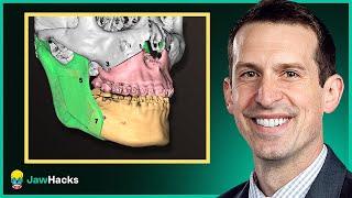 Jaw Surgery: How to Plan, Who to Trust, and What to Expect