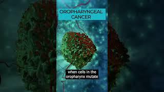 Oropharyngeal Cancer: Understanding Head and Neck Cancer ️🩺