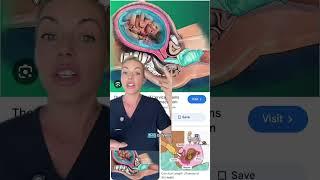 Everything that goes INSIDE you during pregnancy!  #pregnant #pregnancytips