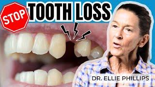 Prevent Tooth Loss as You Age