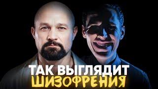 Это ПЕРВЫЕ ПРИЗНАКИ ШИЗОФРЕНИИ! Как не пропустить СКРЫТЫЕ СИГНАЛЫ БОЛЕЗНИ?