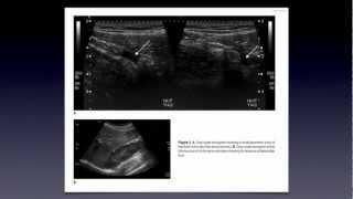 Ultrasound Article Review Nov 2012