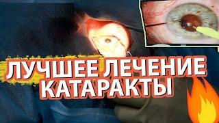 ЛЕЧЕНИЕ   КАТАРАКТЫ  /  Лучшее  из лучших  SUB  ENG  #катаракта