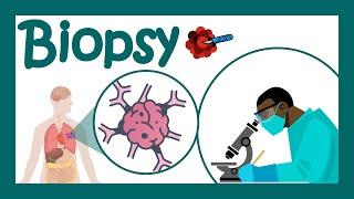 Biopsy | What are biopsies used to diagnose? | How many types of biopsy are there?