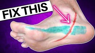 Your Plantar Fasciitis Won’t Go Away Until You Do This!