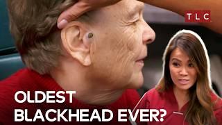 The 55-Year Blackhead Mystery! | Dr Pimple Popper TLC
