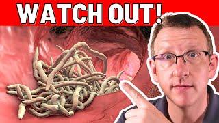 10 TOP early warning signs of PARASITES (ACT RIGHT NOW!)