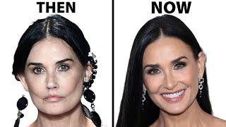 Demi Moore's NEW FACE | Plastic Surgery Analysis