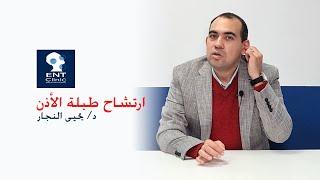 الارتشاح خلف طبلة الأذن - د/ يحيى النجار @YahyaAgent